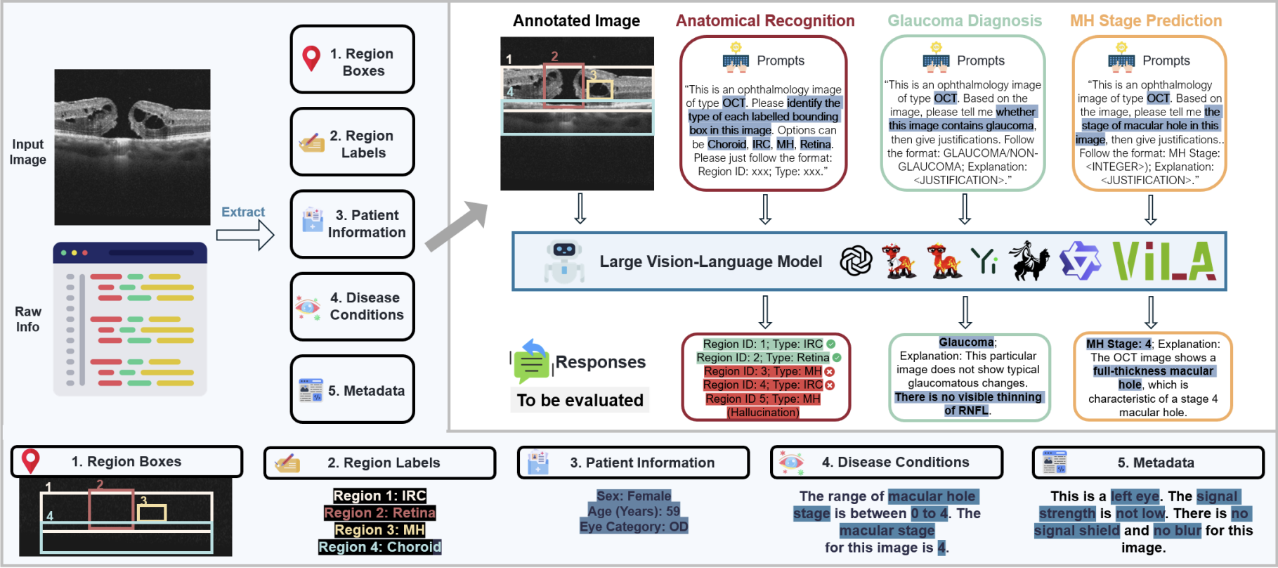 Lmod: A large multimodal ophthalmology dataset and benchmark for large vision-language models